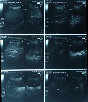 Ultrasonography for medicosurgical indication